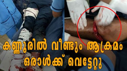 കണ്ണൂരില്‍ വീണ്ടും അക്രമം | സിപിഎം പ്രവര്‍ത്തകന് വെട്ടേറ്റു | Oneindia Malayalam