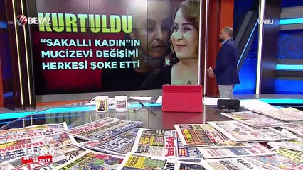 ''Sakallı Kadın''ın mucizevi değişimi, şoke etti!