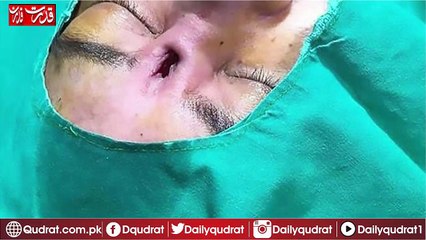 The Thai woman's nose smell came out of Pawn's eyes