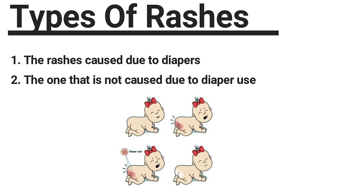 Important Information On Diaper Rash You Should Know