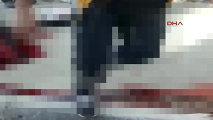 Çorum Sokak Ortasında Önce Eşini Öldürdü, Sonra İntihar Etti