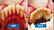 These little habits are affecting your oral health || Health Tips