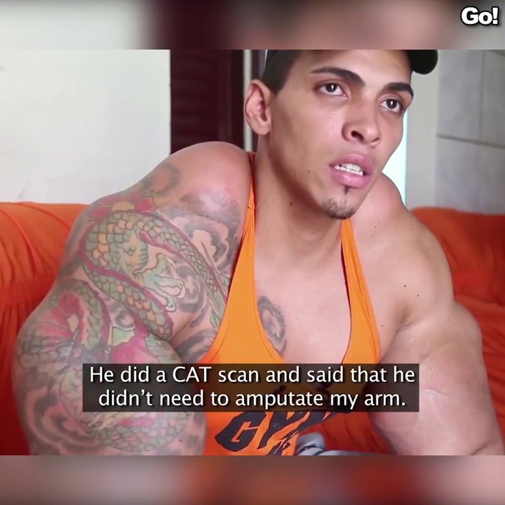 Ce gars a fait beaucoup trop d'injections de synthol dans ses muscles...