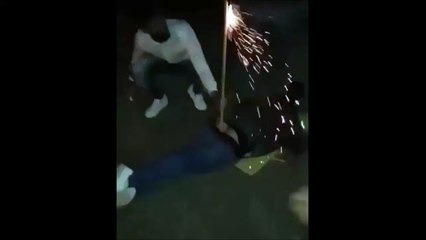 Il se met un feu d'artifice entre les fesses... Idée bien débile