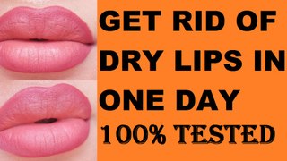Dry Lips Home Remedies DIY 100%Results
