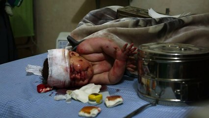 23 civiles muertos en Siria, la mayoría en ataques rusos (OSDH)