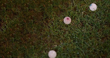 İskoç Taraftarlar, Tek Gözü Görmeyen Futbolcu İçin Sahaya Yapay Göz Attı