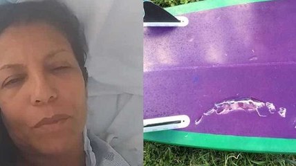 Surfista brasileira é atacada por tubarão no Havaí