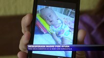 Desesperada madre pide ayuda para medicamentos de su bebe con hidrocefalia