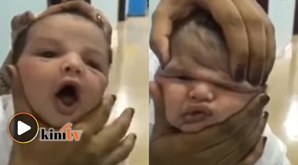 Penyek muka bayi, jururawat dipecat
