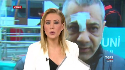 Olta Kurşunu Başına İsabet Etti