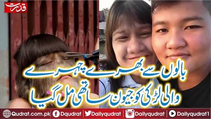 A girl with a hairy hair got found Live Partner