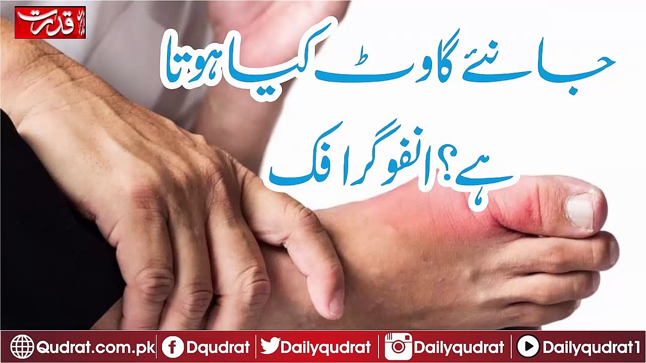 Know What is a gout Infographics