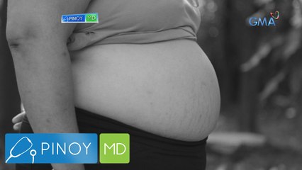 Pinoy MD: Abdominal fat, paano mawawala?