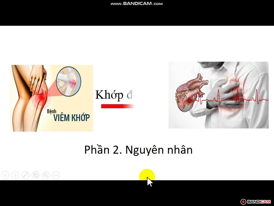 Nguyên nhân khớp đớp tim