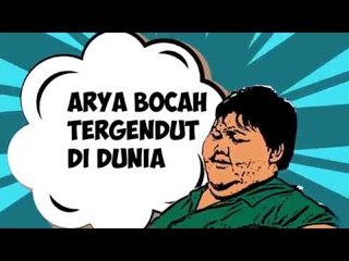 Mengunjungi Arya Permana, Bocah Tergendut di Dunia