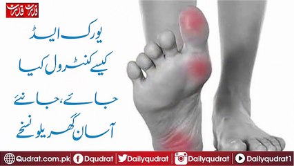 remedies-to-control-uric-acid