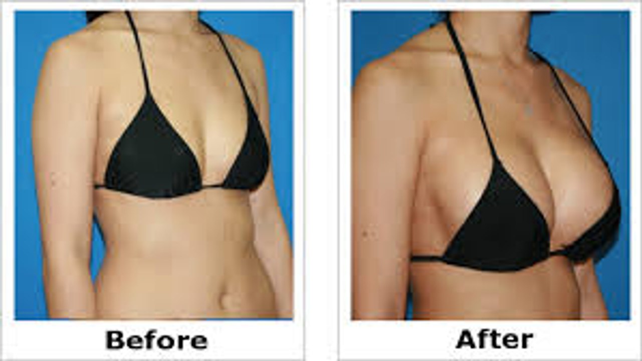 New Treatment For Diabetes Comes From The Tips Of Breasts