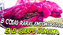 8 COSAS RARAS ENCONTRADAS EN EL CUERPO HUMANO