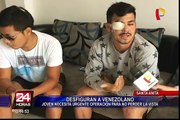 Santa Anita: joven venezolano queda desfigurado tras brutal ataque