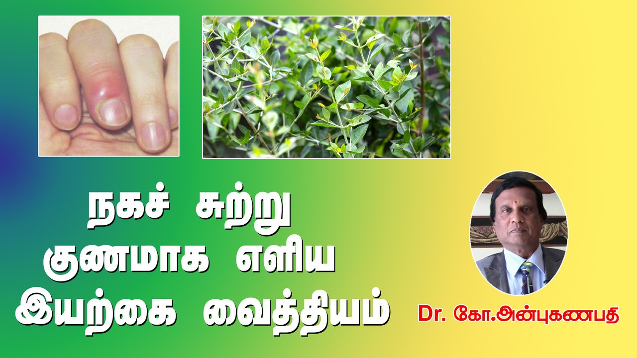 நகச் சுற்று குணமாக இயற்கை வைத்தியம்
