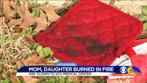 Mother, Daughter Suffer Burns After Wax on Stove Ignites