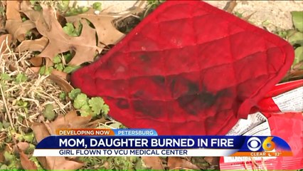 Mother, Daughter Suffer Burns After Wax on Stove Ignites