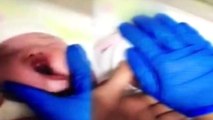 Sağlık Bakanlığı, Hemşirenin Yeni Doğmuş Bebeğin Yüzünü Sıktığı Görüntüler İçin İnceleme Başlattı!