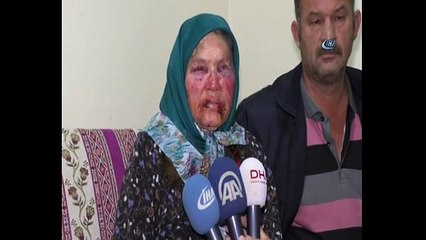 "Oğlunun arkadaşıyım' diye kapıyı çalıp yaşlı kadını öldüresiye dövdü