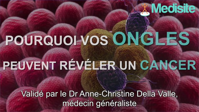 Pourquoi vos ongles peuvent révéler un cancer