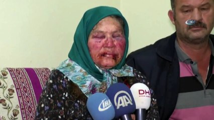 'Oğlunun Arkadaşıyım' Diye Kapıyı Çalıp Yaşlı Kadını Öldüresiye Dövdü
