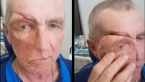 Quand cet homme enlève sa prothèse faciale, le trou qu’il a au visage est carrément impressionnant