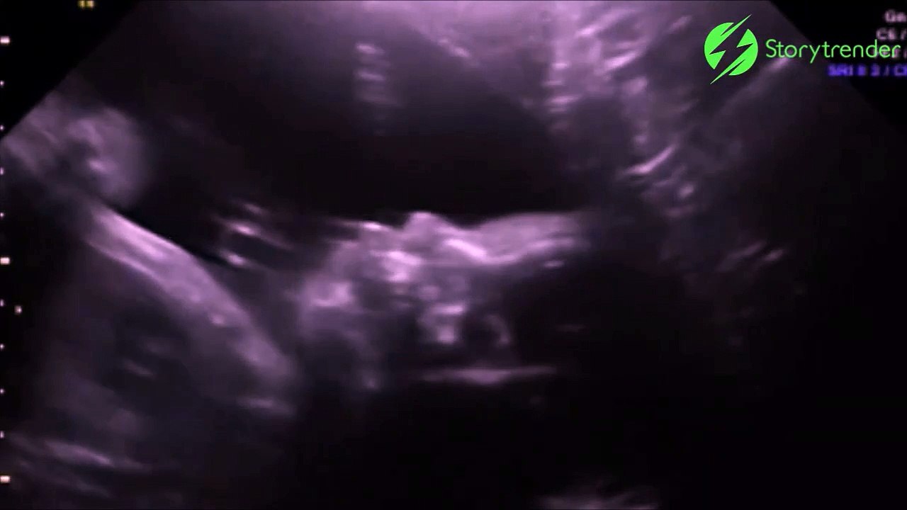 uin bébé fait coucou du ventre de sa mère