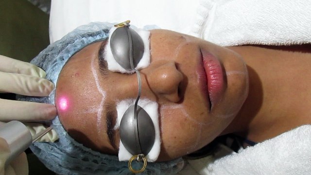 Pigmentation Removal in Delhi, Laser Pigmentation Treatment in Delhi By Best Dermatologist in Delhi
