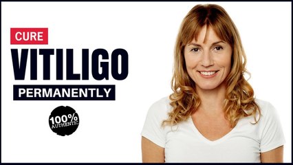 how to remove vitiligo from lips – Home remedies Treatment at home