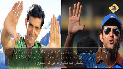 نجوم يعانون من عاهات ورغم ذلك من مشاهير العالم