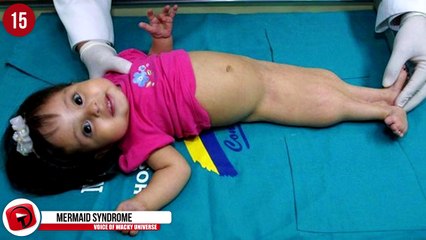 18 Strange Physical Mutations