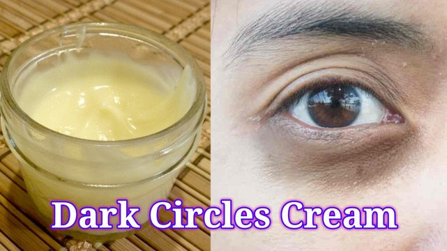 काले घेरों से कैसे छुटकारा पाएं/Magical Home Remedy to Remove Dark Circles