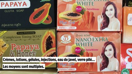 Dépigmentation volontaire : un phénomène tabou assez répandu