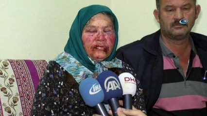 Yaşlı kadının darp edilmesinde kullanılan bant ve bardak kriminal incelemeye gönderildi