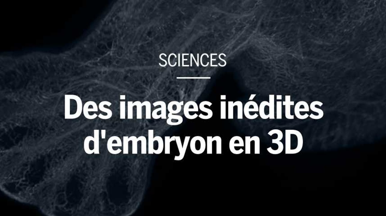 Des images inédites d'embryons et de fœtus humains