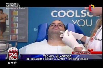 EEUU:  Dígale adiós a su papada con esta nueva técnica