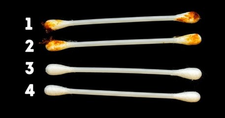 Your Ears Can Indicate Your Health- Don't Ignore These 8 Factors