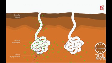 Santé - Quand la sueur prédit le diabète