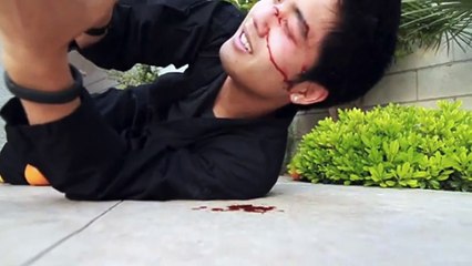 5 Youtubers Who Hurt Themselves While Making A Video Pt.1 - Roman Atwood, Lance Stewart, NigaHiga