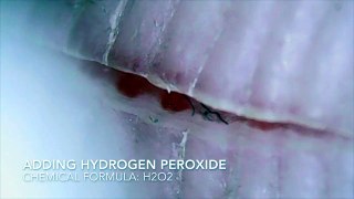 Adding Hydrogen Peroxide to an Accidental Finger Cut with a Microscope