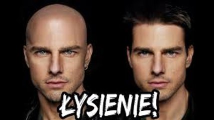 Dlaczego łysiejemy - EUREKA