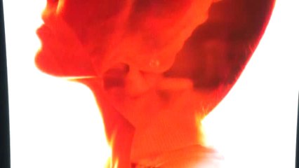 Sahte Zayıflama İlaçlarında Olması Gerekenin 4 Katı Etken Madde Tespit Edildi"