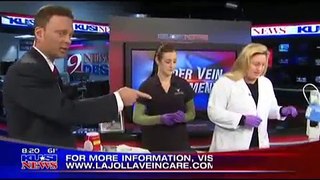 Does Spider Vein Treatment Work? San Diego News