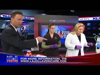 Does Spider Vein Treatment Work? San Diego News